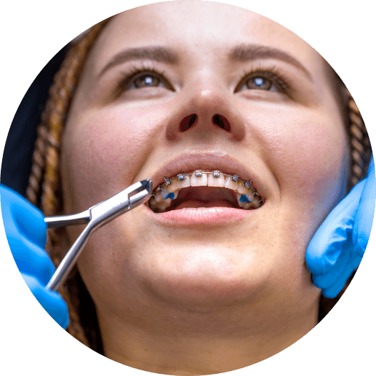 Orthodontics-Orthodontic FAQs