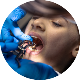 Pediatric-Dentist-Pediatric-Dental-Emergencies