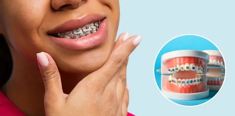 The Science of Smiles_ What Really Happens During Orthodontic Treatment